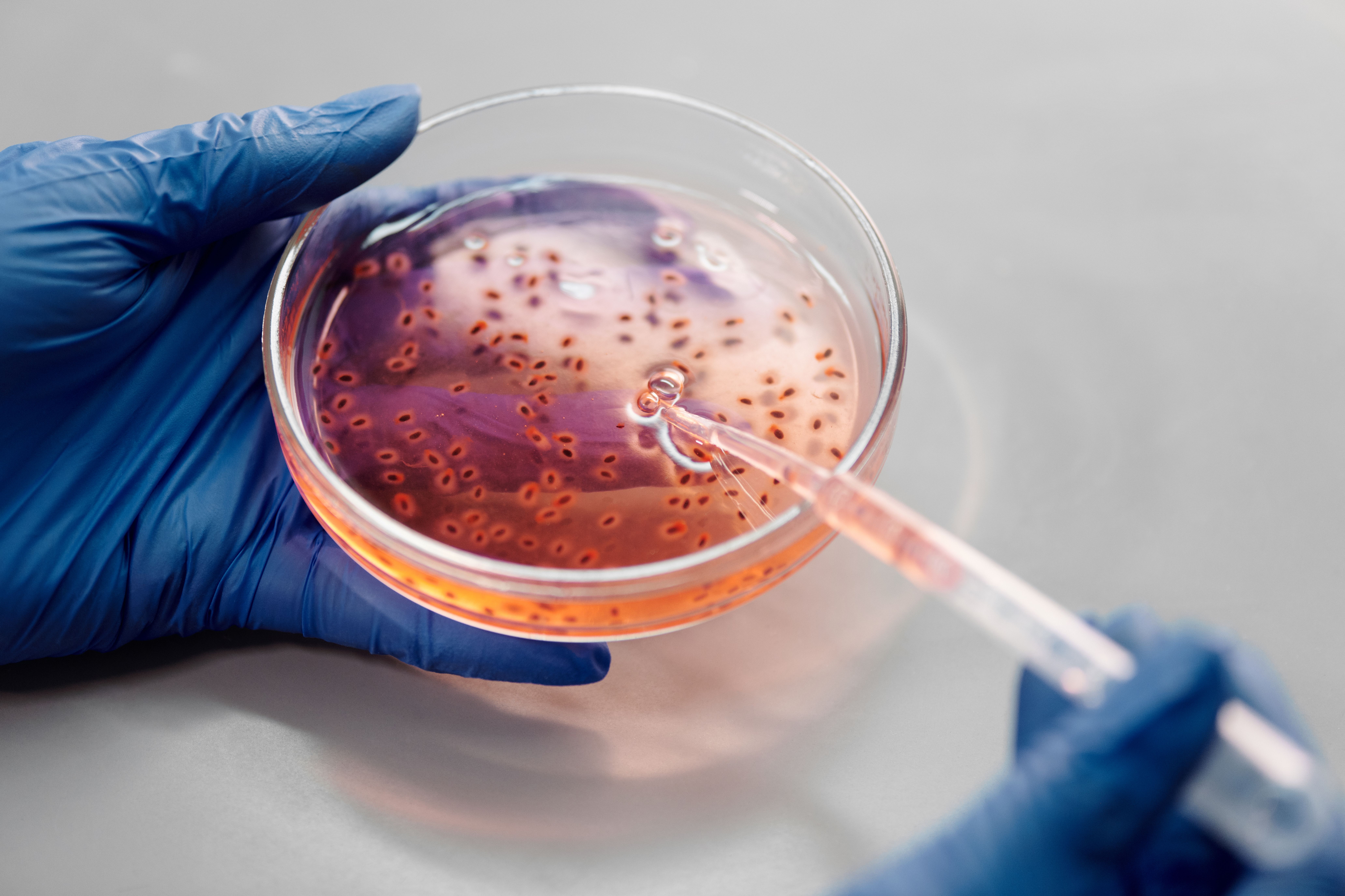 Umbilical Cord Derived MSCs