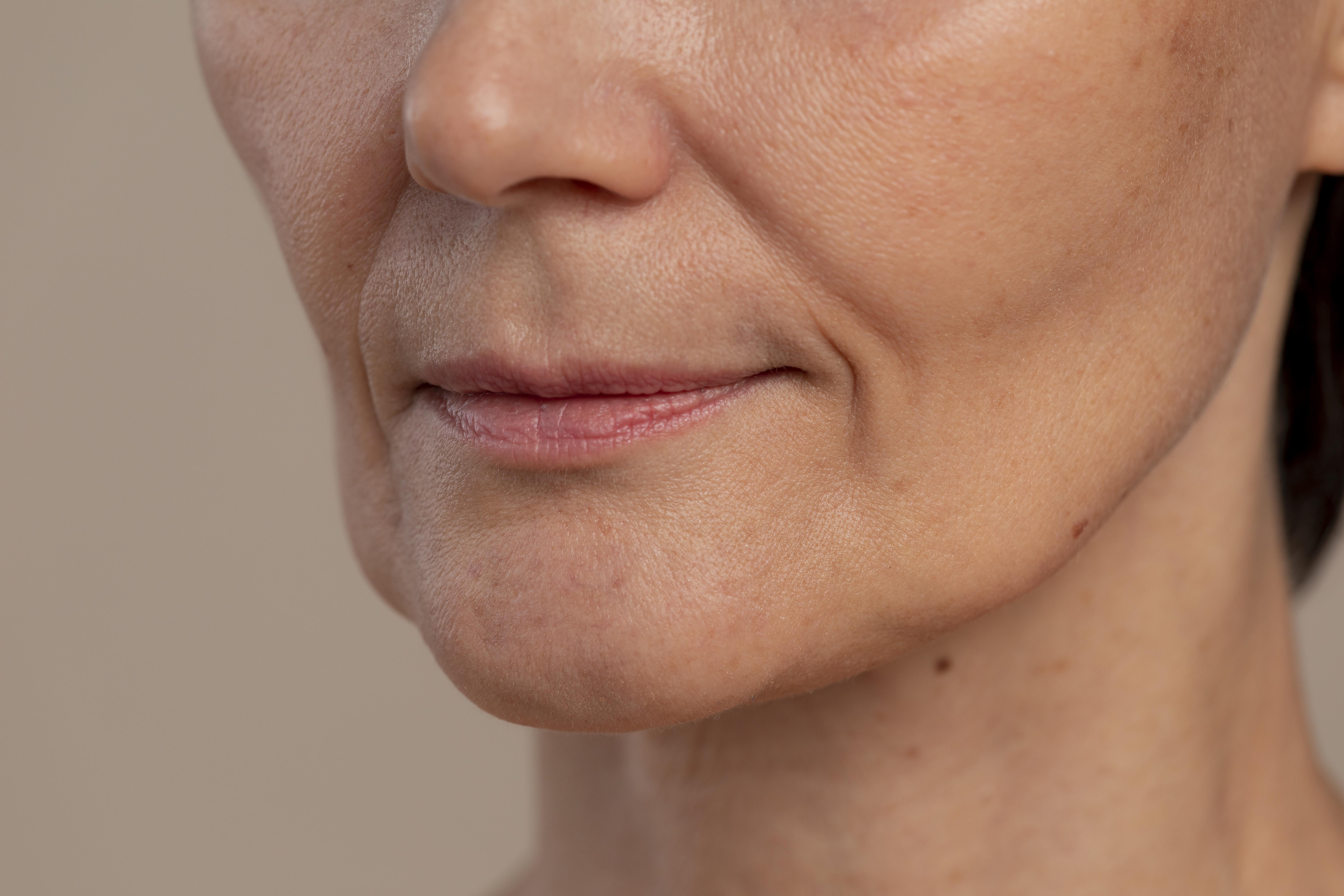 Skin Booster Image 2